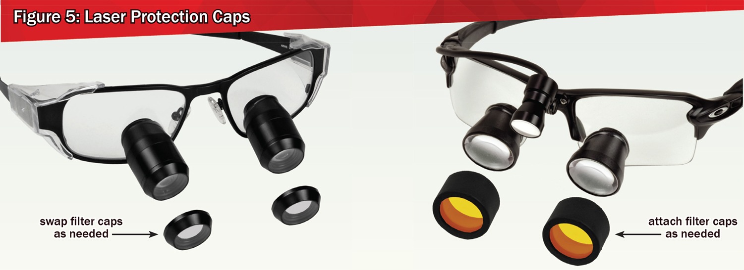 Laser Protection Options for Loupes SurgiTel