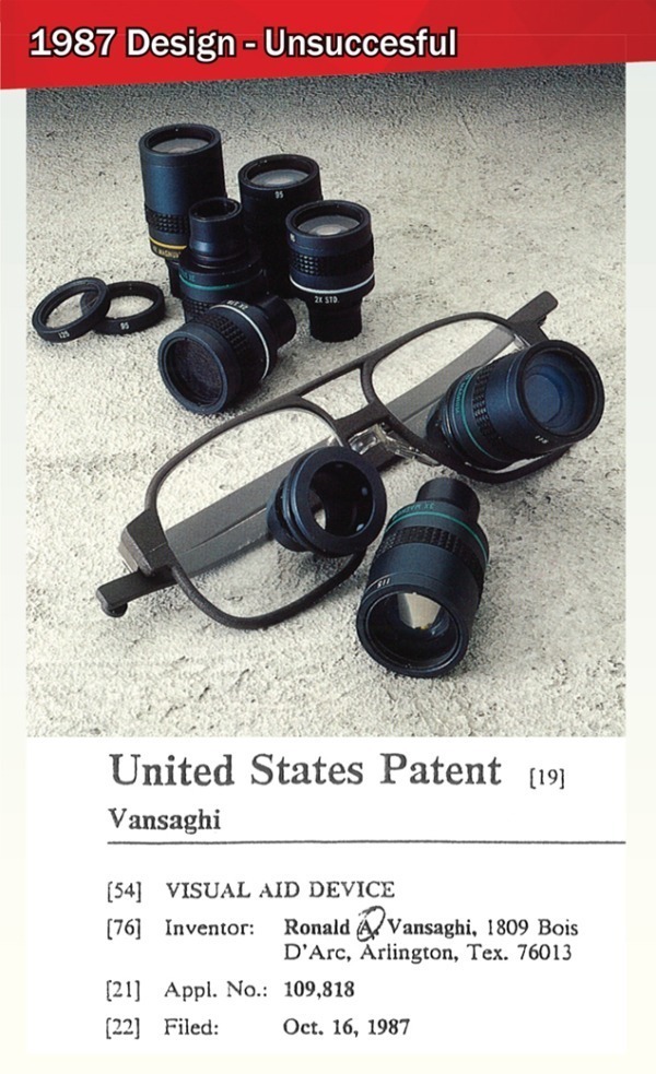 Multiple Magnification Loupes 1987 to Today SurgiTel
