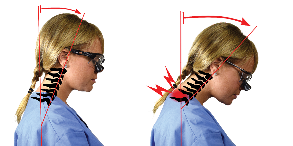 Female medical practitioner with SurgiTel loupes and ergonomics
