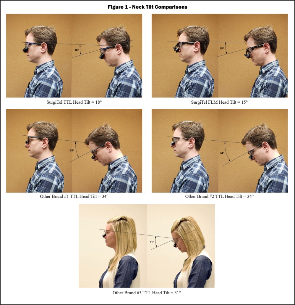 True Ergonomics from SurgiTel The Truth about Declination Angle