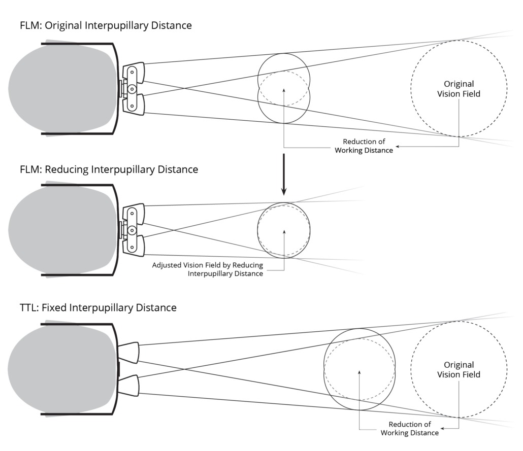 Diagram showing the adjustment of Interpupillary distance on an FLM changes the Working Distance