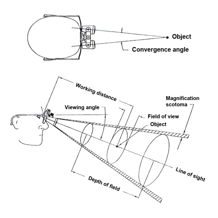 SurgiTel Loupes Headlights Telescope Support VIdeo library