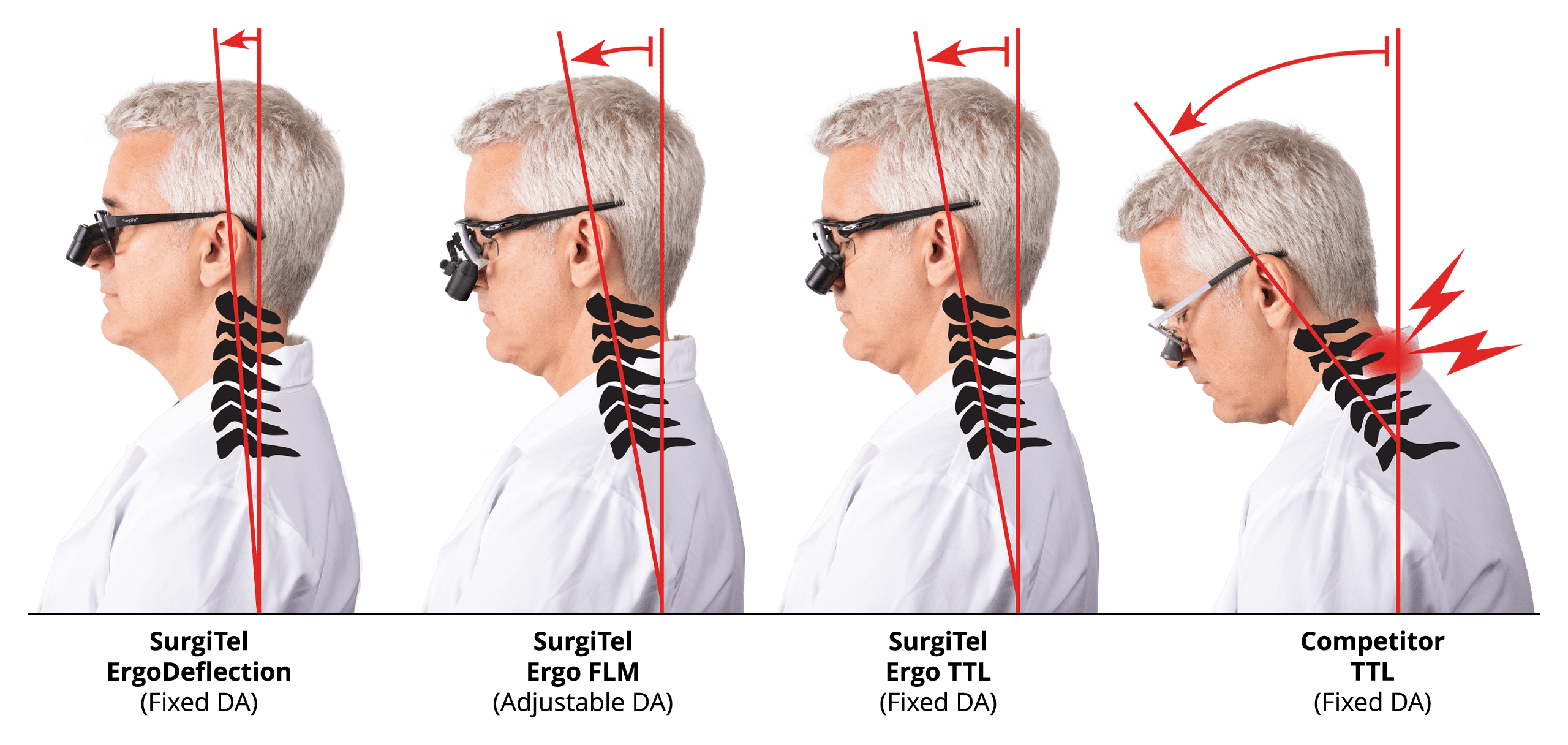 Rose TTL Loupes – BiBODENT Company