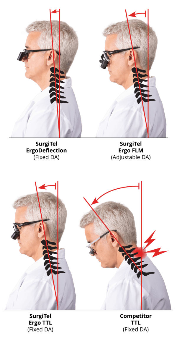 SurgiTel Surgical loupes Dental loupes Veterinarian loupes