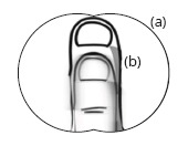 Double Vision - Ideal Field (a) but Vertical Double Images (b)