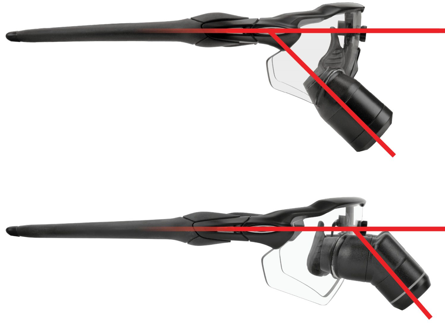 Hybrid TTL Loupes Best of Ergonomics and Direct Vision SurgiTel